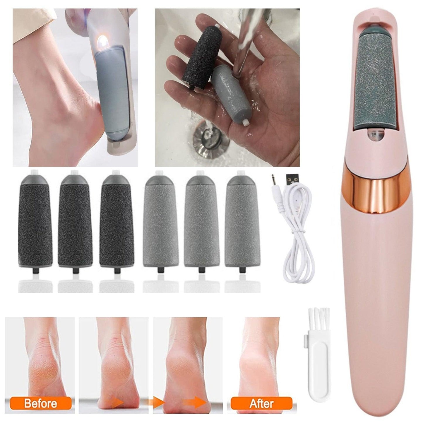 Professional Electric Foot File Callus Remover Pedicure Machine Apparatus for Heels Grinding Device Foot Corns Remove Roller - Yiepp Store